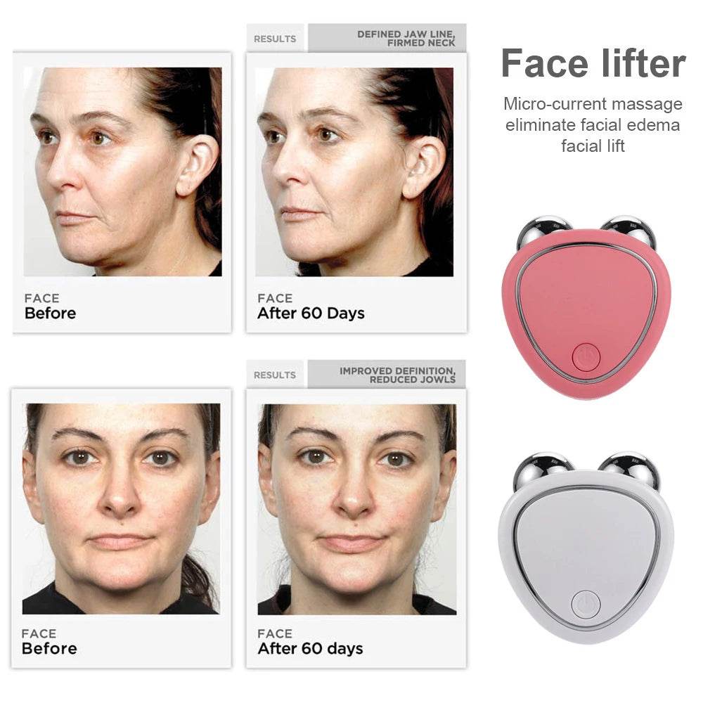 Fitzsi Essentials EMS face lifting device for Youthful Skin shown before and after results for a firmer appearance